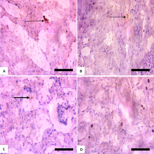 Figure 3. Immunohistochemistry of protein kinase B (PKB) in the heart of rats after withdrawal of sodium arsenite exposure for 4 weeks. (A) Control: shows positive and high expression of PKB; (B) 10 mg/kg NaAsO2: shows lower expression of PKB than control; (C) 20 mg/kg NaAsO2 shows lower expression of PKB than control; (D) 40 mg/kg NaAsO2: shows lower expression of PKB than control. The result shows that following withdrawal of NaAsO2, the expressions of the survival protein (Akt/PKB) are still lower than the control. Scale bar (for A, B, C, and D) = 5.04 × 3.87 mm. The slides were counterstained with high definition hematoxylin and viewed ×400 objectives.