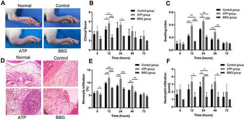 Figure 1 P2X7R regulates the development of acute gouty arthritis in rats. (A) At 12h, clinical manifestations of right ankle joint in rats among ATP group, BBG group and control group. (B and C) Clinical score and swelling index of three groups of rats at each time point. (D) Inflammatory cells infiltrated the synovial tissue of the right ankle joint in three groups of rats, at 24h. (E and F) Infiltration of mononuclear cells and neutrophils in the synovial tissue of the ankle joint among the three groups. * P<0.05, **P< 0.01, ***P< 0.001.