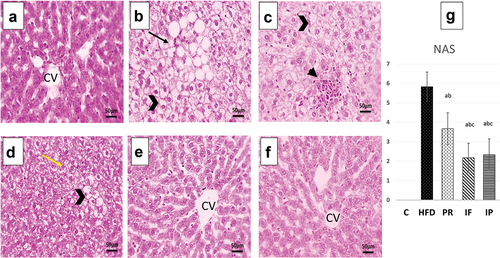 Figure 3. Microscopic pictures of H&E-stained hepatic sections from C group (A), HFD group (B,C), Pr group (D), if group (E) and IP group (F). Hepatic sections from control group (A) indicates that the hepatic parenchyma, hepatic cords, central veins (CV), portal regions, and sinusoids are normal. Hepatic sections from HFD group (B,C) show diffuse ballooning degeneration in hepatocytes (opened arrowhead), focal macrovesicular steatosis (thin arrows), infiltration of many inflammatory cells (mononuclear cells and eosinophils) in portal areas (thick arrow), and aggregates in sinusoids cells (arrowhead). Hepatic sections from Pr group (D) show diffuse mild hydropic degeneration in hepatocytes (yellow arrows) and localized ballooning degeneration (opened arrowhead). Microscopic images of H&E-stained hepatic slices from the if and IP groups (E and F respectively) show almost normal hepatic parenchyma, normal radially organized hepatic cords, and normal CV. The HFD group shows a significant increase in NAS which is improved markedly by PR, if and IP. IF and IP show more improvement in NAS than PR group. C, control group; HFD, high fat diet group; Pr, probiotic group; IF, intermittent fasting group; IP, combined intermittent fasting and probiotics group; CV, central veins..