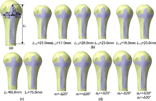 Figure 5. Generation of group of cloverleaf plates. (a) Initial parameter values of parametric cloverleaf plate: L 1 = 70.0 mm; L 1.2 = L 1.3 = L 1.4 = 20.0 mm; a 1 = a 2 = a 3 = 0°; h 1.1 = h 1.2 = h 1.3 = h 1.4 = h 1.5 = 2 mm. (b–d) Group of cloverleaf plates with different parameter values. (b) Change of L 1.2, L 1.3 and L 1.4. (c) Change of L 1. (d) Change of parameter a 1, a 2 and a 3.