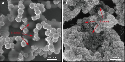 Figure 5 SEM images of the concentrated (A) Fe3O4@Ag-Van–Staphylococcus aureus complexes and (B) the complexes covered with Au@Ag NPs. (C) SERS spectra of different concentrations of S. aureus obtained with the combined use of Fe3O4@Ag-Van MNPs and Au@Ag NPs. (D) SERS spectra collected from 20 randomly selected spots on the Fe3O4@Ag-Van–S. aureus/Au@Ag NP complex substrate.Abbreviations: MNPs, magnetic nanoparticles; NPs, nanoparticles; SERS, surface-enhanced Raman scattering; SEM, scanning electron microscopy; Van, vancomycin.
