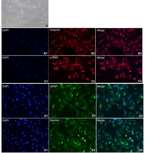 Figure 3 Expression of cellular markers in primary isolated APSCs.Notes: (A) After about 1 week of culture, NPSCs gradually activate. APSCs exhibit typical activation characteristics, with large cell volume, no lipid droplets in the cells, and a multi-angled shape. (B1–B3) APSCs’ positive expression marker protein vimentin. Blue is the nuclear marker DAPI; red is the vimentin-positive expression localization (200×); (C1–C3) APSCs’ positive expression marker protein α-SMA. Blue is the nuclear marker DAPI; red is the α-SMA-positive expression localization (200×); (D1–D3) APSCs’ positive expression marker protein GFAP. Blue is the nuclear marker DAPI; green is the GFAP-positive expression localization (200×); (E1–E3) APSCs’ positive expression marker protein desmin. Blue is the nuclear marker DAPI; green is the desmin-positive expression localization (200×).Abbreviations: APSC, activated pancreatic stellate cell; GFAP, glial fibrillary acidic protein; NPSC, normal pancreatic stellate cell; α-SMA, alpha-smooth muscle actin.