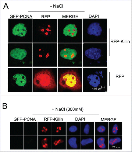 Figure 4. RFP-Killin is localized in cell nucleoli in non-Sphase cells. (A) The RFP-Killin or RFP expression vectors were transiently co-transfected with GFP-PCNA into Cos-E5 cells for 24 h. Non-S-phase cells marked by diffusive GFP-PCNA nuclear staining were visualized via confocal fluorescent microscopy. Note that RFP-Killin resided in the nucleoli. The scale bar was at 4.09 μm. (B) The RFP-Killin and GFP-PCNA expression vectors were transiently co-transfected into Cos-E5 cells and, treated with 300 mM NaCl (in situ salt extractions) prior to immunostaining. Representative images of RFP-Killin in the nucleoli were acquired by confocal fluorescent microscopy. Note that none of RFP-Killin positive nucleoli showed any GFP-PCNA signals. The scale bar was at 2.16 μm.