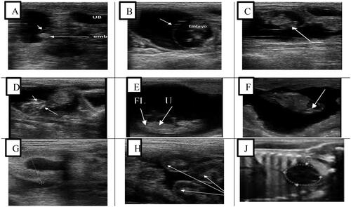 Figure 2. Ultrasonograms of genital tracts of pregnant ewes; (A–C) Pregnant ewe at 35th day, (D) beginning of ossification in the head; pregnant ewe at 60th–70th day, (E,F) all foetal parts are clear, umbilical cord; pregnant ewe at 60th–70th day, (G, H) placentome, (J) ribs shadow, heart location.