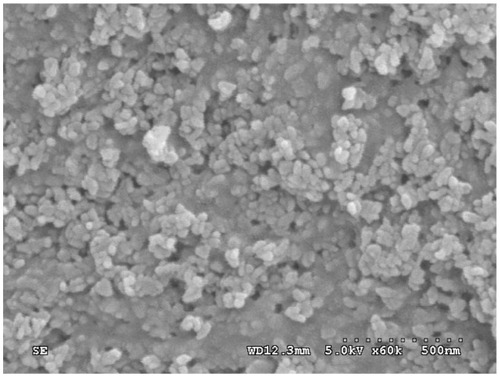 Figure 4 Scanning electron microscopy images of the n-CDAP–PCL–PEG–PCL composite scaffold surface.Abbreviation: n-CDAP–PCL–PEG–PCL composite, nano calcium-deficient apatite and poly(ɛ-caprolactone)–poly(ethyleneglycol)–poly(ɛ-caprolactone).