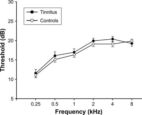 Figure 1 No significant differences in auditory thresholds between tinnitus and control groups.