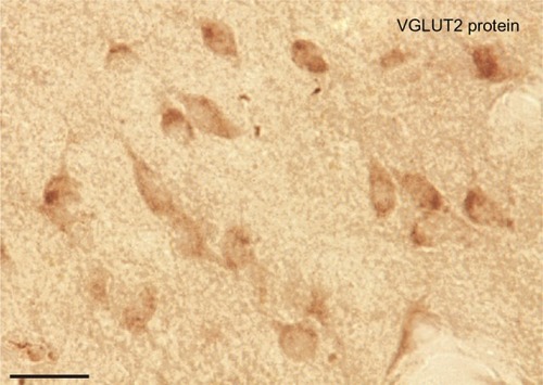 Figure 9 VGLUT2 protein expression in the pulvinar is largely confined to cell bodies and processes instead of terminals. Scale bar is 25 µm.
