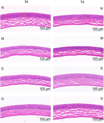 Figure 11 The form of cornea (N:the normal group; (M) the model group; (S) the solution group; (G) the gel group. The area marked by yellow line segment represented corneal epithelium layer.