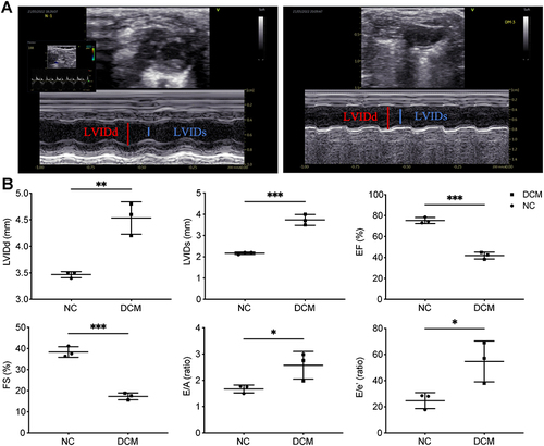 Figure 3 Changes of cardiac structure and function in DCM mice. (A) Representative pictures of echocardiography. (B) Echocardiogram measurements (LVIDd, LVIDs, EF, FS, E/A, E/e′) of the DCM and NC groups. n = 3, *p < 0.05, **p < 0.01, ***p < 0.001.