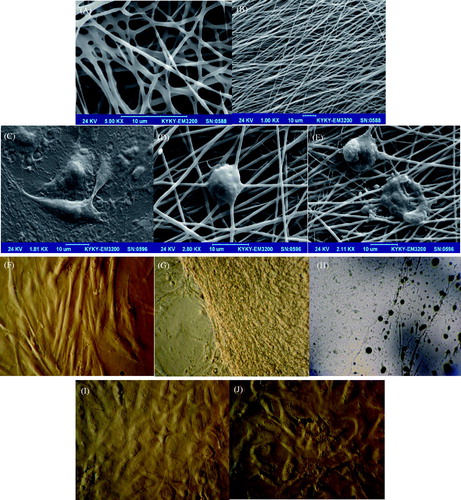Figure 4. SEM images of designed mats: (A) non-oriented gelatin nanofibers and (B) oriented gelatin nanofibers. Cultured stem cells before induction airlifting on control (TCPS) surface (C); after induction airlifting on oriented gelatin nanofibrous mat (D); and on non-oriented mat (E); inverted microscopic images of cultured stem cells; before induction airlifting on control (TCPS) surface (F); culture on oriented gelatin nanofibrous mat (G); and non-oriented mat (H); after induction airlifting on oriented gelatin nanofibrous mat (I); and on non-oriented (J).