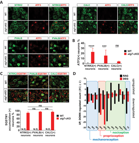 Figure 4. Selective vulnerability of the axons of mechanoreceptive and proprioceptive DRG neurons in uninjured Avil-atg7-cKO mice. (A) IF staining against ATF3 with neuronal markers, parvalbumin, NTRK2 or CALC in the DRG of WT and Avil-atg7-cKO mice. Scale bar: 50 μm. (B) Quantification of the number of ATF3 (+) neurons in each subtype of DRG neurons. ***; p < 0.001, ****; p < 0.0001, ns; non-significant. (C) Double IF staining against SQSTM1 and NTRK2, PVALB or CALC in the DRG of WT and Avil-atg7-cKO mice. Scale bar: 50 μm. Quantification shows the percentage of SQSTM1 inclusion (+) neurons in the DRG of WT and Avil-atg7-cKO mice. N.D; non-detected. (D) Comparison of the number of neuronal subtype marker genes those expressions altered more than 2-fold (up and down) in Atg7-DEG and RAG.