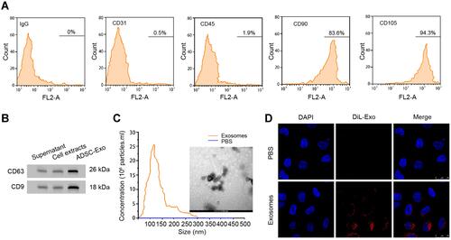 Figure 1 Exosomes derived from ADSCs could be internalized by ASMCs. (A) Flow cytometry to detect the expression of CD31, CD45, CD90, CD105, and negative control IgG on surface of ADSCs. (B) Western blotting experiment to detect the protein markers CD63 and CD9 in supernatant, cell extracts or exosomes from ADSCs. (C) Size distribution of exosomes was measured by Nanoparticle Tracking Analysis (NTA). (D) Exosomes isolated from ADSCs were labelled by DiLC18 (DiL) and administrated to ASMCs for 24 hours, fluorescence was detected by confocal experiment.