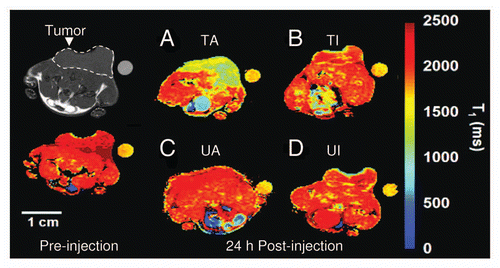 Figure 5 Transverse T1 maps of drug-treated and untreated EL-4 tumors in animals injected with PS-active (GST-C2A-Gd) and PS-inactive (GST-C2A-Gd) contrast agents. Color scale indicates T1 values for image voxels. In this example, contrast agents were matched for relaxation rate. Images were acquired immediately before injection of contrast agent (a T1 map acquired from a tumor before injection is shown on the left-hand side) and at 24 h after injection. Reference capillary was placed adjacent to the tumors, which were implanted on lower areas of backs of animals. Position of the tumor is indicated on the gray-scale image. (A) Etoposide+cyclophoshamide-treated tumor in animal injected with PS-active GST-C2A-Gd (TA). (B) Drug combination-treated tumor in animal injected with PS-inactive GST-C2A-Gd (TI). (C) Untreated tumor in animal injected with PS-active GSTC2A-Gd (UA). (D) Untreated tumor in animal injected with PS-inactive GST-C2A-Gd (UI). Drug combination-treated tumor in an animal injected with PS-active contrast agent shows greater accumulation at 24 h after injection (A). Courtesy of Dr. Kevin Brindle, University of Cambridge, UK.