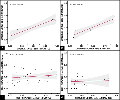 Figure 6. Correlation graphs comparing the fraction of proliferating T- and B-cells at the TLS site and matched tumor site, in PDM and NDMM. Correlation graphs showing the relationship between the fractions of proliferating CD8+Ki67+ T-cells at the TLS site to those in the matched tumor in PDM (A) and NDMM (C); and the proportions of proliferating CD20+Ki67+ B-cells at the TLS site to those in the matched tumor in PDM (B) and NDMM (D). Correlation coefficient (R) and p values calculated by Spearman’s rank correlation test.