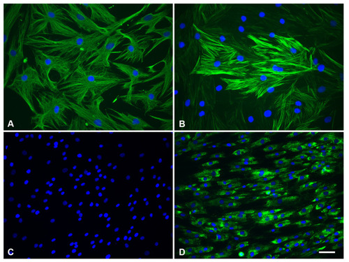 Figure 1 (A) Immunolocalization of vimentin, (B) α-smooth muscle actin, (C) AE1/AE3, and (D) type I collagen (green, AlexaFluor 488) in seeded dermal fibroblast cells. DNA staining (DAPI, blue). Scale bar: (A and B) = 100 μm; (C and D)= 50 μm.