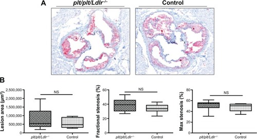 Figure 1 No changes on plaque burden in plt/plt/Ldlr −/− mice.