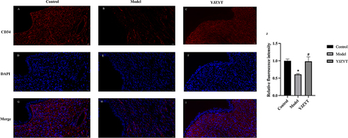 Figure 7 Changes in angiogenesis of rat uterus. (A–I) Immunofluorescence of the uterine receptivity marker, CD34 (red), and nuclear marker, DAPI (blue) (Magnification: 400×). (J) Relative fluorescence intensity of rats in control, model, and YJZYT groups. Data are presented as mean ± SEM; *Compared to the Control group, *P < 0.05. #Compared to the Model group, #P < 0.05.