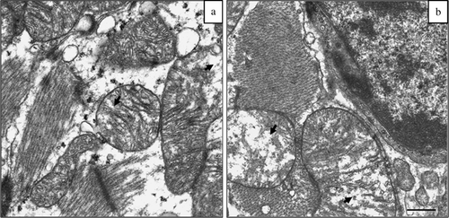 Figure 3.  Representative transmission electron micrographs from the left myocardium of (3a) a broiler fed the placebo-containing diet and (3b) a broiler fed the diet containing MM extract. Bar = 1 µm. For the most part, myocardial mitochondria showed normal morphology with well-defined and dense cristae, but in some areas of the cardiomyocytes degenerative changes in the mitochondrial structure were evident. Examples of typical changes in mitochondrial morphology in broilers fed the placebo-containing diet (3a) and broilers fed the diet spiked with MM extract (3b). It is noteworthy that the changes in the mitochondria (arrows) such as swelling, vacuolization, and destruction of matrices and cristae were qualitatively evident in both groups, but are more severe in broilers fed the diet spiked with MM extract in comparison with broilers fed the placebo-containing diet.
