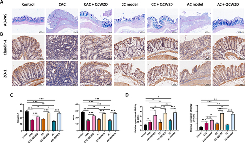 Figure 5 QCWZD improves intestinal epithelial barrier structure and function in DSS and AOM/DSS mice. (A) AB/PAS staining of goblet cells; (B) Immunohistochemical of Claudin-1 and ZO-1 in colon tissue; (C) Semi-quantitative immunohistochemical analysis of Claudin-1 and ZO-1; (D) The mRNA expression levels of REG-3γ and MUC2 in each group. *P < 0.05, **P < 0.01, ***P < 0.001.