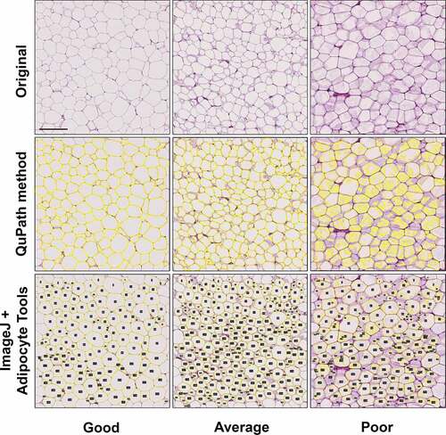 Figure 1. Comparison of the ability of QuPath and ImageJ plugin Adipocyte Tools to detect the adipocytes in images of H&E stained 5 µm adipose tissue sections. Section quality and concomitant success of correctly rendering the cell area was graded on a visual scale of good-average-poor. See text for details. Scale bar 200 µm.