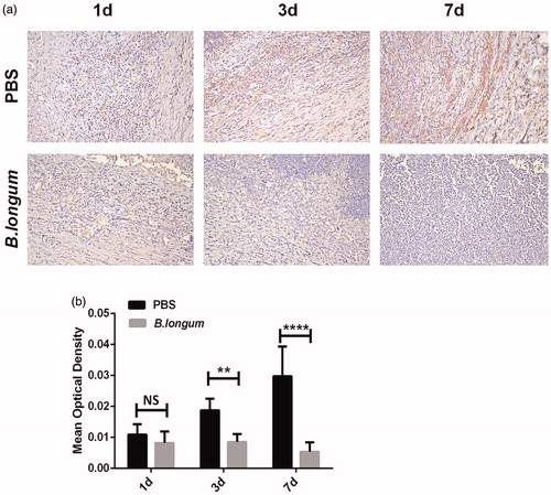 Figure 6. Bifidobacterium longum effects on HIF-1α expression in tumors. (a) Expression of HIF-1α in tumors at different times after injection of B. longum and PBS. (b) Quantitative analysis of average optical density value of HIF-1α-positive expression in each group (n = 3, **p < .001,****p < .0001).