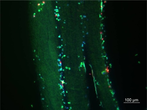 Figure 5 Adipose-derived stem cells (ADSCs) cultured on and in between layer-by-layer paper-stacking membrane scaffold (three layers) and the viability of ADSCs detected by live/dead staining and 4′,6-diamidino-2-phenylindole (DAPI) staining.Note: Scale bar, 100 μm.