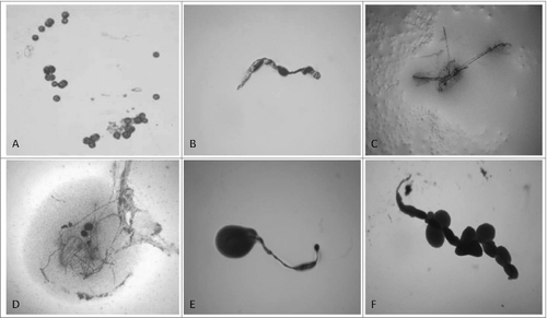 Figure 1. “Non-cultivable elements” from blood isolates (No1; 34; 37, 48; 91; 96). Light microscopy of: (A, B, C) spherical and filamentous forms found in semisolid agar during the first phase/week of cultivation; (D, E, F) initiation of growth from filamentous elements during the second phase/week of cultivation. Magnification: 200x
