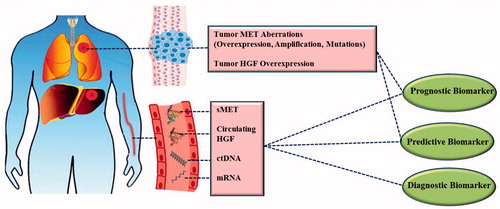 Figure 3. Available HGF/MET-related diagnostic, prognostic and predictive biomarkers in human cancers. Different tissue-based and circulation-based aberrations of HGF/MET pathway can be used as biomarkers.