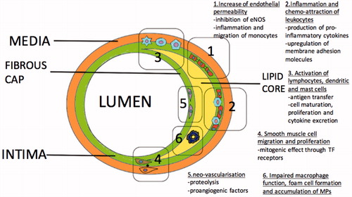 Figure 5. Mechanisms associated with initiation and progression of atherosclerosis mediated by Microparticles (MPs).