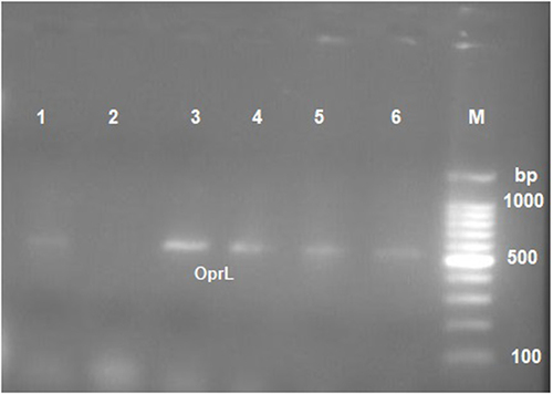 Figure 1 PCR results showing the P. aeruginosa Opr L gene, M: marker (100 bp), Line 1 and 3: positive control, Lines 2: negative control, lines 4,5,6: strains of P. aeruginosa.