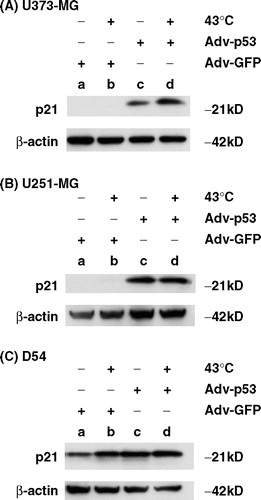 Figure 5. Immunoblotting assay for the expression of p21 protein after p53 over-expression, heat-shock treatment or their combination. Cell lysates were prepared from (a) U373-MG, (b) U251-MG and (c) D54 cells, which were treated with (a) Ad5CMV-GFP only, (b) Ad5CMV-GFP + heat-shock treatment at 43°C for 2 h, (c) Ad5CMV-p53 only and (d) Ad5CMV-p53 + heat-shock treatment at 43°C for 2 h. Proteins were subjected to immunoblot analysis using anti-p21 antibody. Anti-β-actin antibody was used to confirm equivalent protein loading.