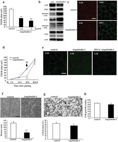 Figure 1. Effects of angubindin-1 on the epithelial barrier, the proteins of tTJ, YAP and JNK, cell migration, invasion and proliferation in Sawano cells.(a) Bar graph of TEER values representing barrier function in Sawano cells treated with 2.5 μg/ml or 5 μg/ml angubindin-1 for 24 h. **p < .01, vs control. (b) Western blot analysis for LSR, TRIC, pYAP, YAP, pJNK and JNK in Sawano cells treated with 2.5 μg/ml angubindin-1 for 24 h. (c) Immunocytochemical analysis for LSR (red) and TRIC (green) in Sawano cells treated with 2.5 μg/ml angubindin-1 for 24 h. Bar: 5 μm. (d) TEER values representing barrier function of Sawano cells treated with 2.5 μg/ml angubindin-1 from 2 h to 48 h and then after washing out angubindin-1 for 24h. **p < .01, vs control. (e) Immunocytochemical staining for LSR (green) and F-actin (Alexa 594-Phalloidin, red) in Sawano cells treated with 2.5 μg/ml angubindin-1 for 24 h and then after washing out angubindin-1 for 24 h. Bar: 5 μm. (f) Migration assay of Sawano cells treated with 2.5 μg/ml angubindin-1 for 6 h. Bar: 100 μm. **p < .01, vs control. (g) Matrigel invasion assay of Sawano cells treated with 2.5 μg/ml angubindin-1 for 24 h. Bar: 400 μm. *p < .05, vs control. (h) Proliferation assay of Sawano cells treated with 2.5 μg/ml angubindin-1 for 24 h.