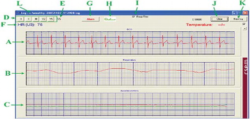 Figure 2.  Screen sample view of biomedical parameters wireless acquired from Whealthy® shirt and elaborated by a PC through proper software. (A) ECG signal, (B) respiratory system, (C) signals of vertical and horizontal acceleration, (D) ECG lead selection (D1, D2, D3, V2, V5), (E) selected lead, (F) heart rate, (G) button for the generation of alert signal to PPU, (H) PPU position (standing or lying), (I) respiratory signal filter, (J) button for clear acquired data, (K) button for acquire new data, and (L) file name.