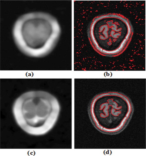 Figure 6. Results of the proposed method and B.N. Li et al. (Citation2011) on a noisy MRI image. (a, b) Bias field & final contour using B.N Li’s method (c, d) Bias field & final contour using the proposed method.