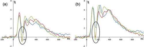 Figure 4. Grandaverage ERP averaged across electrodes 58 (T5), 64, and 65 and across electrodes 90, 95, and 96 (T6) illustrating the left (a) and right (b) N170, respectively (the gray oval indicates the N170 peak). ERP amplitudes were more negative in response to both healthy infant faces (green line) and faces of infants with a cleft lip (red line) compared to scrambled faces (blue line), and in response to healthy infant faces compared to faces of infants with a cleft lip between 132 and 162 ms after stimulus onset (N170).