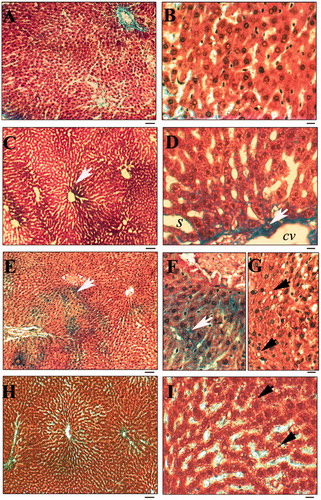 Figure 4. Effect of chronic restraint stress and high-sucrose intake on hepatic fibrosis. Masson’s trichrome stained liver sections from control (group C: panels A, B) that received a standard diet alone, chronic stress (St: C, D), 30% sucrose diet (S30: E–G), and 30% sucrose diet + chronic stress (S30 + St: H, I) groups. White arrows show the presence of collagen around the central vein and in the lumen of blood vessels. Black arrows define the presence of fat globules within hepatocytes. Scale bar 50 µm (A, C, E, H) and 10 µm (B, D, F, G, I). S: sinusoids; CV: central vein.