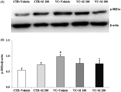 Figure 4. Effects of MOTILIPERM on the level of p-IRE1α protein in the varicocele-induced endoplasmic reticulum stress response. (A) Western blot of testis. (B) Level of p-IRE1α protein for each group. Beta-actin used as a loading control to normalize the p-IRE1α protein levels in each sample. p-IRE1α: phosphorylated inositol requiring transmembrane kinase/endoribonuclease 1α; CTR + vehicle: normal control group; CTR + M 200: normal rats administered 200 mg/kg MOTILIPERM; VC + vehicle: varicocele-induced rats; VC + M 100: varicocele-induced rats administered 100 mg/kg MOTILIPERM; VC + M 200: varicocele-induced rats administered 200 mg/kg MOTILIPERM. #Significantly different from CTR + vehicle group (p < 0.05). *Significantly different from VC + vehicle group (p < 0.05).