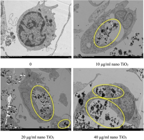 Figure 8 Effects of nanoparticulate TiO2 (nano-TiO2) on apoptosis of primary cultured Leydig cells (LCs).Note: Yellow ovals represent deposition of nano-TiO2 particles, signifying accumulation in cytoplasm and LC injury.
