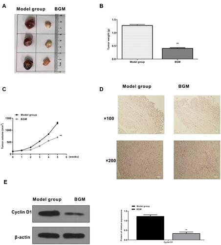 Figure 7 BGM inhibits tumor growth of melanoma in vivo. (A–D) The effect of BGM on tumor growth of melanoma in vivo was analyzed by nude mice tumorigenicity assay. The WM239 cells were injected into the nude mice (n = 6). The mice in the BGM group were intraperitoneally treated with BGM (10 mg/kg) (A) Representative images of dissected tumors from nude mice were presented. (B) The average tumor weight was calculated and shown. (C) The average tumor volume was calculated and shown. (D) The expression levels of Ki-67 of the tumor tissues were measured by immunohistochemical staining. (E) The expression of Cyclin D1 was measured by Western blot analysis in the tumor tissues of the mice. The results of Western blot analysis were quantified by ImageJ software. Data are presented as mean ± SEM. Statistic significant differences were indicated: ** P < 0.01.