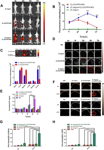 Figure 7 In vivo FL, PA and US imaging. (A) Fluorescence images of tumor-bearing mice at different time points (6, 24, 48, 72 h) after injection of PBS and CL-ICG-PFH-NPs in the B. longum group, CL-ICG-PFH-NP group and B. longum + CL-ICG-PFH-NPs group, the black dotted circle marks the tumor nodules. (B) Quantitative fluorescence in the intensity of tumor site, there was a significant increase of the fluorescence intensity in the B. longum + CL-ICG-PFH-NP group when compared with the other two groups after injection. (n=5, **P<0.01, ***P<0.001). (C) Ex vivo fluorescence images of major organs and tumors dissected from mice 48 h post-injection in CL-ICG-PFH-NP group and B. longum + CL-ICG-PFH-NPs group. Quantitative fluorescence in the intensity of major organs and tumors, there was a significant difference in the fluorescence intensity in the B. longum + CL-ICG-PFH-NP group when compared with the CL-ICG-PFH-NP group (n=5, ***P<0.001). (D) PA images of tumor-bearing mice at different time points (0, 6, 24, 48, 72h) after injection of PBS and CL-ICG-PFH-NPs in the PBS group, B longum group, CL-ICG-PFH-NP group and B. longum + CL-ICG-PFH-NPs group. (E) The corresponding PA signals at the tumor sites of tumor-bearing mice after injection of PBS and CL-ICG-PFH-NPs in the PBS group, B longum group, CL-ICG-PFH-NP group and B. longum + CL-ICG-PFH-NP group at different time points. There was a significant increase of the PA signals in the B. longum + CL-ICG-PFH-NP group when compared with the other three groups after injection 48 h. The difference was also detected in the B. longum + CL-ICG-PFH-NP group at 48 h and 24 h. (n=5, ****P<0.0001). (F) Ultrasound images of tumor-bearing mice before and after laser irradiation 48 h after PBS and CL-ICG-PFH-NPs injection in the PBS group, B longum group, CL-ICG-PFH-NP group and B. longum + CL-ICG-PFH-NP group. The red circle marks the area where the intensity is sigificantly enhanced. (G) EI in B-mode and (H) EI in CEUS imaging before and after irradiation in different groups. There was a significant difference in the B. longum + CL-ICG-PFH-NP group when compared with the other three groups after irradiation, the difference was also detected in the B. longum + CL-ICG-PFH-NP group before and after irradiation (n=5, ****P<0.0001).Abbreviations: ICG, indocyanine green; PFH, perfluorohexanes; FL, fluorescence; PA, photoacoustic; US, ultrasound; EI, echo intensity; B-mode, brightness modulation; CEUS, contrast-enhanced ultrasound.