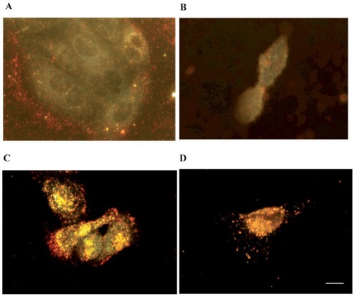 Figure 9 Dark field light scattering images of CTAB-capped Au-nanorods and SV40 largeT NLS/Au-nanorod conjugates after 2 h incubation with cells. A) CTAB-capped Au-nanorods in HaCaT normal cells. B) CTAB-capped Au-nanorods in HSC cancer cells. C) SV40 large T NLS/Au-nanorod conjugates in HaCaT normal cells. D) SV40 large T NLS/Au-nanorod conjugates in HSC cancer cells. Scale bar: 10 μm.