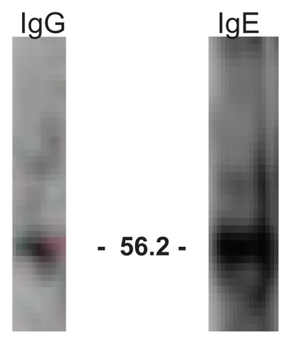 Figure 2 Immunoblot analysis of IgG and IgE anti-H1N1 virus antibodies.
