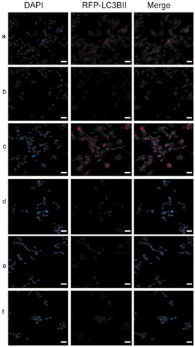 Figure 8. Immunofluorescent staining showed that the LC3B secretion was remarkably enhanced in shRNA‑17A‑transfected cells, compared with that in pcDNA-17A‑transfected cells. (a) Normal SH-SY5Y cells; (b) negative control; (c) SH-SY5Y cells transfected with 17A shRNA; (d) scramble control; (e) SH-SY5Y cells transfected with pcDNA-17A; (f) cells transfected with pcDNA-control.Scale bar, 20 μm. Merged images were shown in each row. In the merged images red indicates the presence of LC3B. Nuclei were counterstained with DAPI and are shown in blue.