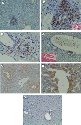 Figure 1 Immunohistochemical staining of LTA in TCRα− / − × AIM− / − mouse liver. (a) At a lower magnification, LTA immunoreactivity was prominent in the portal areas, but not in hepatic sinusoidal cells. (b) In the same sample, at a higher magnification of the portal area, LTA immunoreactivity was observed in the cytoplasm of polymorphic inflammatory cells. H&E staining of the same bile duct is shown in the right lower corner. (c) In another TCRα− / − × AIM− / − mouse liver, LTA was detected in the cytoplasm of bile duct epithelial cells (arrowheads), and connective tissue of Glisson's sheath. (d) The left lower corner shows H&E staining of the portal tract. Red blood cells and white blood cells can be observed in the portal vein branch. (P: portal vein). Amorphous materials were intermingled with blood cells in the lumens of the portal vein branch (arrows). (e) In the hepatic lobules, LTA was mainly located in the hepatocytes adjacent to the central vein. (C: central vein, P: portal vein). (f) In the same sample, at a higher magnification of the hepatic lobules, LTA localizations were clearly observed each of the single hepatocytes (C: central vein). (g) LTA immunoreactivity was not detectable in wild-type (C57BL/6J) mice liver.