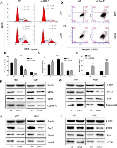 Figure 4 Knockdown of GALE induces cell cycle arrest and apoptosis in human glioma cells. (A–C) U87 and U251 cells were transfected with NC or si-GALE and then subjected to cell cycle analysis by flow cytometry. Three independent experiments were carried out in each group. (D, E) Flow cytometry was used to detect the apoptosis rate of cells using the membrane protein V-FITC antibody and PI staining. (F–I) Western blot analysis of the expression levels of known cell cycle regulators, cell apoptosis markers, epithelial–mesenchymal transition (EMT) markers and possible cell signaling pathway proteins. *P < 0.05; ***P < 0.001.