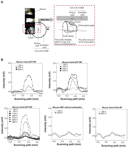 Figure 4 SSB examination of a liver tumor. (A) Setup scheme. (B) The scanning curves of all test mice at different times. (C) The variation of magnetism M of all test mice at different times. (D) The analysis comparison of SSB and MRI.Abbreviations: AFP, alphafetaprotein; CEA, carcinoembryonic-antigen; MF, magnetic fluid; SSB, scanning superconducting-quantum-interference-device biosusceptometry; MRI, magnetic resonance imaging.