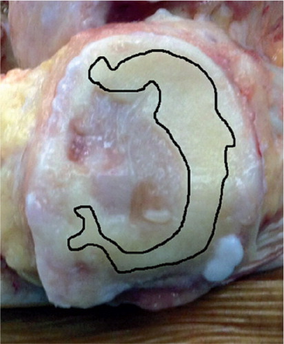 Figure 3. Marking of the normal cartilage of the patella.