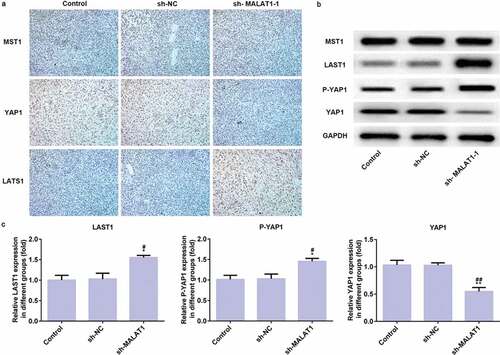 Figure 11. LncRNA MALAT1 interference inhibits tumor growth through Hippo-YAP signaling pathway. (a) The proteins (MST1, LATS1, and YAP1) related to Hippo-YAP signaling pathway were detected by immunohistochemistry. (b/c) The proteins (MST1, LATS1, P-YAP1, and YAP1) related to Hippo-YAP signaling pathway were detected by western blot. *P < 0.05 and **P < 0.01 vs. control group. #P < 0.05 and ##P < 0.01 vs. sh-NC group