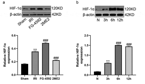 Figure 1. HIF-1α expression is upregulated after liver IR or H/R injury. (a) Western blotting analysis of HIF-1α expression and the band density ratio relative to β-actin in liver tissues of each group. (b) Western blotting analysis of HIF-1α expression and the band density ratio relative to β-actin in BRL-3A cells in different reoxygenation times (0, 3 h,6 h, and 12 h). ***P < 0.001 versus the sham or N group; ### P < 0.001 versus the IRI or 3 h group