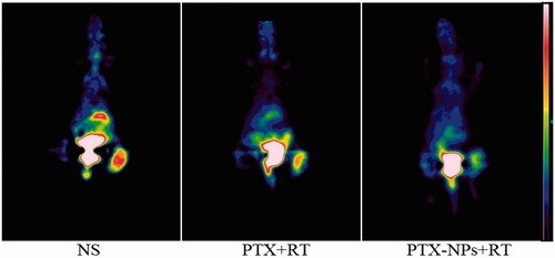 Figure 4. Representative 18F-FDG PET images of mice after one full day treatment.
